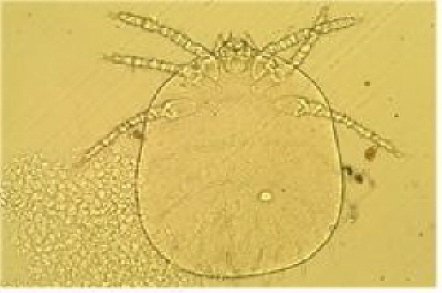 ▲현미경으로확대촬영한활순털진드기유충사진/질병관리본부질병매개곤충과자료